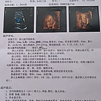 今天老婆刚照的四维彩超，很好奇😄大家帮我看下是乔治👦还是佩奇👧