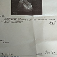 今天第五十二天  打到了胎心  这是二胎  希望能是个乔治  大宝是个女儿  想凑个好字