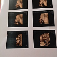 今天做了四维彩超   一次性过   医生说我羊水不是很多  其它都很好  期待我的小宝贝😘😘