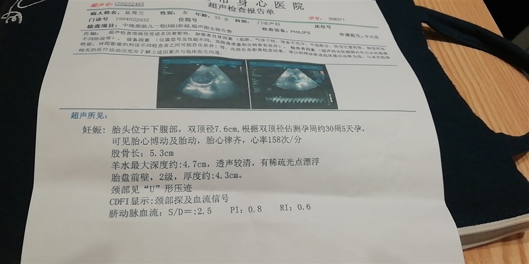 ☹️😣超碎了的玻璃心，脐带绕颈一周，个子又不小，居然还比实际大了两周，是该高兴呢还是担忧呢？