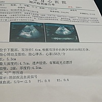 ☹️😣超碎了的玻璃心，脐带绕颈一周，个子又不小，居然还比实际大了两周，是该高兴呢还是担忧呢？