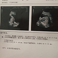 孕八周时的b超，有宝妈会看孕囊大小看男女的吗帮忙看下吧