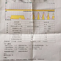 有没有z y