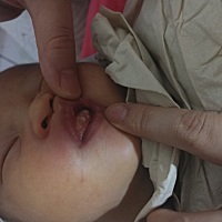 各位宝妈们，你们知道宝宝这是怎么回事吗？