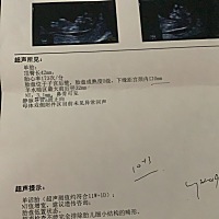 亲们NT高了怎么办