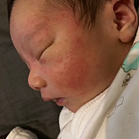 各位宝妈 有谁知道宝宝脸上这些是什么吗