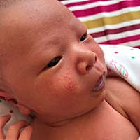 宝宝出生半个月了，脸上长痘痘是怎么回事啊，白头红底的点点，现在坐月子也没法出门去医院，该怎么办啊