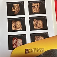 四维顺利通过，各位宝妈们猜猜看是男是女