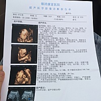 四维超快通过！哪位大神帮忙看看弟弟还是妹妹！