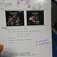 大家帮忙看看男孩女孩，