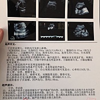 30周的宝宝，能不能帮我看看男孩女孩啊