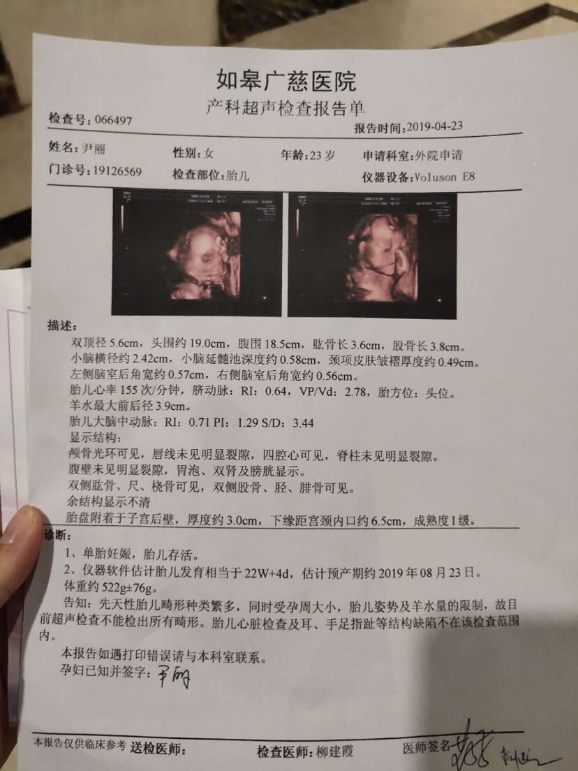 大家帮忙看一下   男孩还是女孩！！