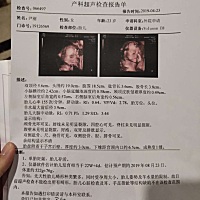大家帮忙看一下   男孩还是女孩！！