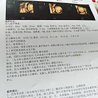 有没有会看男女的，帮忙看看吧，