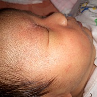 我是宝爸。。。宝宝满脸像豆子一样的东西，各位大神能帮忙么？？？