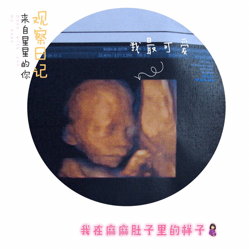 四维彩超的baby和哥哥超级像，希望是个小猪🐷佩奇，哈哈哈