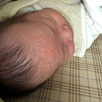 最近宝贝额头长了很多红点点，这是什么？有知道的宝妈吗？