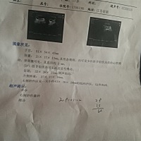 大家帮看一下，第一次流褐色的分泌物去做第一张B超下图，过了八九天期间还是留褐色分泌物做了第二张B超...