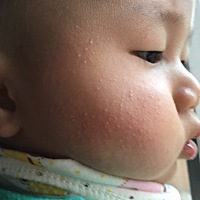 求哪位大神知道，宝宝脸上这是什么？擦什么才能好？谢谢！