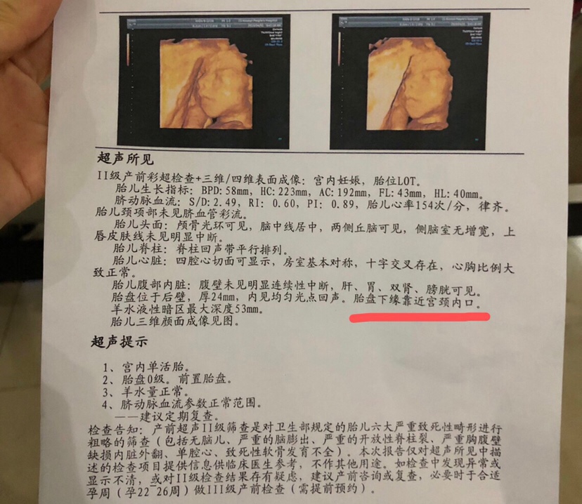 有没有过这种情况的宝妈，胎盘有点低生的时候可以