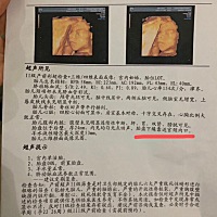 有没有过这种情况的宝妈，胎盘有点低生的时候可以