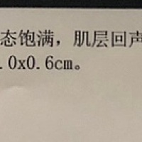 孕五周多，做检查什么也没看到，只有宫内暗区，正常吗？