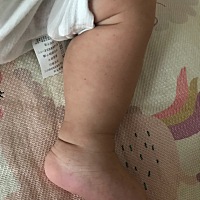 宝宝小腿和脚板很多很小粒的淡红色，不是凸起的，这是什么？