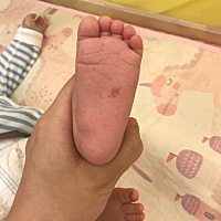 有人知道宝宝这是什么吗