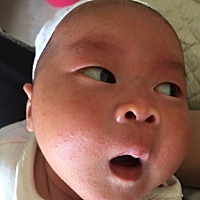 满月后，宝宝脸上长了好多，有人知道这是什么吗？不知道该用什么药