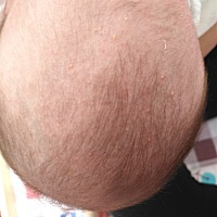 这是什么有人知道吗，起这种疙瘩有事吗。