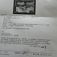 这是怎么回事啊，上次做检查还没有这个情况，孩子倒是没有什么事，这个血窦需要怎么预防也没有说，有没...