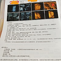 有没有看来是乔治还是佩奇