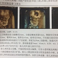 想请问一下各位宝妈腹中宝宝是男孩还是女孩？ 因为是一胎，我和我妈都很喜欢女孩子，所以想要个女宝宝。...