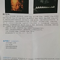 大家帮忙看看是男孩👦还是女孩👧