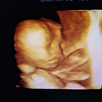 知道怀孕后每天都在煎熬，每次产检都怕出问题，昨天做了第一次四维，为啥嘴唇那么后，还是拍照角度问题...