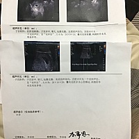 上一张是15号做的，下一张是24号做的。间隔8天，但是孕囊感觉长的速度不够，虽然也有了胎心胎芽，但还是...