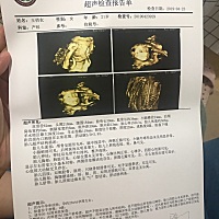 四维图，能看出男女么？这些数据结果是正常的么？医生就草草说了几句，心里还是担心…