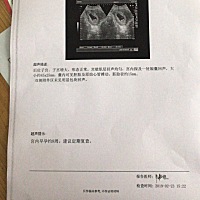 有看得懂男女的么？生了两个女宝宝了 想要个男宝宝