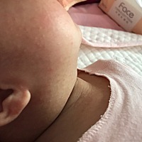 宝宝脸上起了小红点点，下巴 眼睛周围 眉毛上都有，皮肤也很干，平时就用水洗脸  然后摸安宁膏 ，有没有...