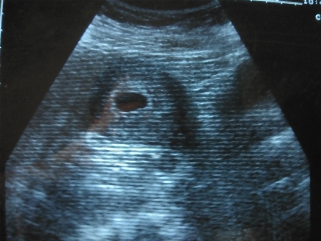 谁能帮我看一下，男孩女孩