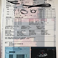今天大排畸 宝宝只照到半张脸 有子宫肌瘤 说胎儿面有5.4*1.7的无回声 不知道这个是什么问题 医生说让查...