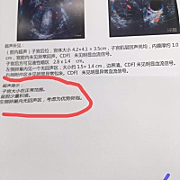 今天去医院检查发现问题又不明白。 想问医生可是人家又忙着下班。不大明白这的问题。有谁懂得给我讲解一下