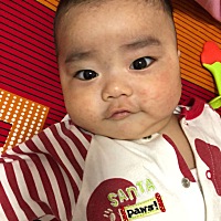 大家帮忙看看，宝宝出的这是什么？ 早晨