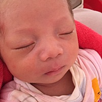 宝宝脸上长这些小点小点红红的怎么办，拍照看起来没那么明显