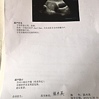 各位妈妈，可以帮我看一下吗，我最后那次月经是3月13日，昨天检查B超，还没有看到胚芽和卵黄囊。验血说...