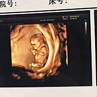 孕13周4天，看着宝宝很可爱，特像他她爸爸，哈哈😄