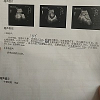 有会看男宝女宝的嘛，纯属好奇☺