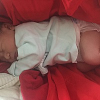 生完宝宝 第七天 奶涨的疼 有硬块 怎么办？现在又发烧头疼