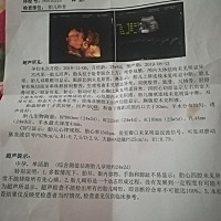 有会看的吗？  24周了，帮忙看看是不是佩奇？