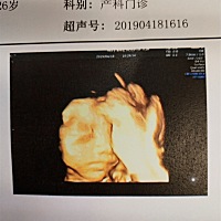 这小孩做四维太调皮了、三次才通过、走了一个半小时的路、大家觉得像谁多一点